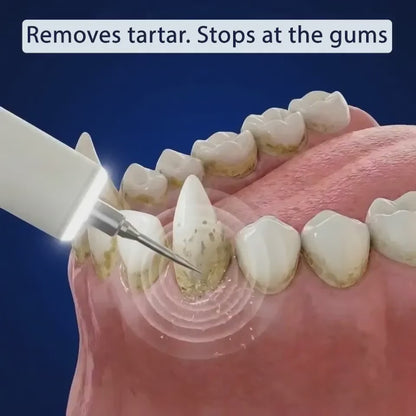 Silent Ultrasonic Plaque & Tartar Remover for Pets